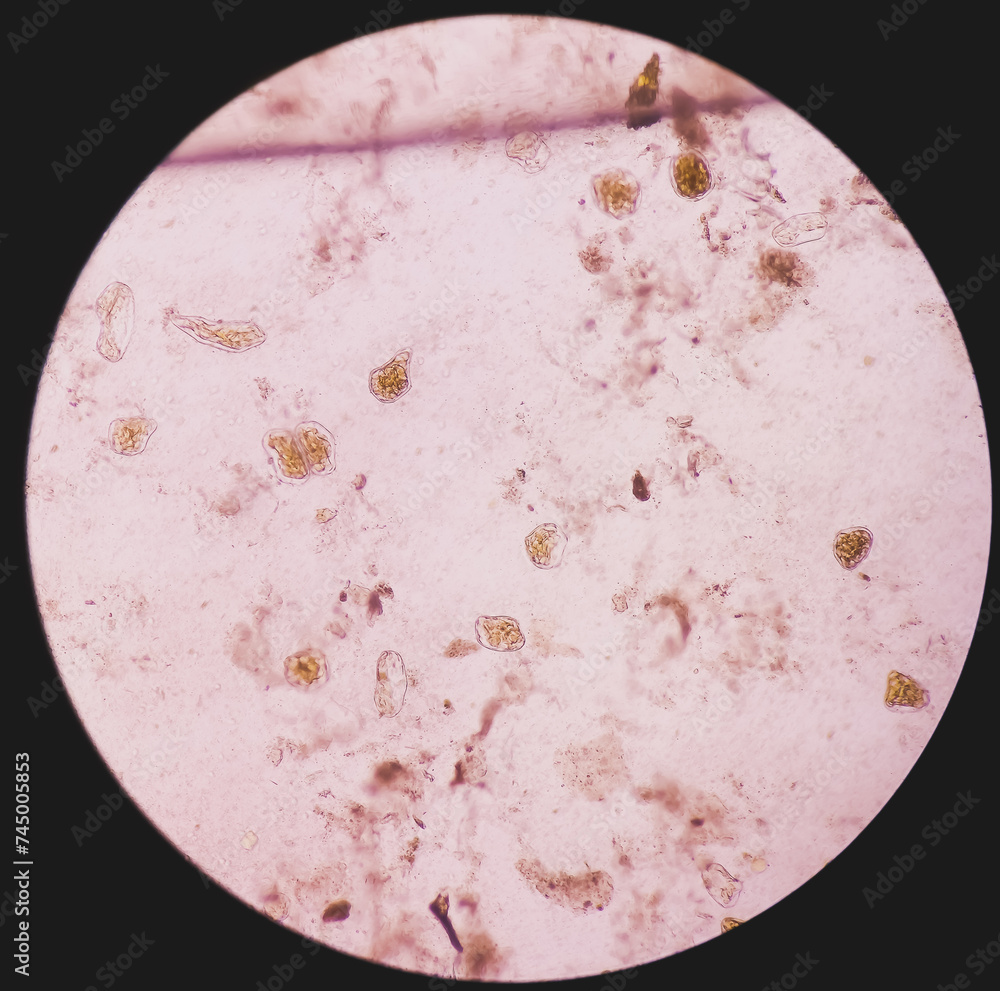 Giardia lamblia cysts and Trophozoite form, muscle fiber in stool examination, under 40X light microscope, selective focus. Giardia lamblia cysts and Trophozoite form, muscle fiber in stool examination, under 40X light microscope, selective focus.