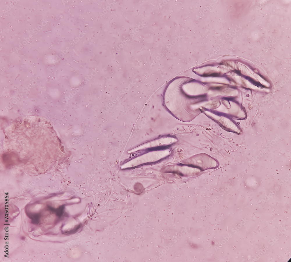 Giardia lamblia cysts and Trophozoite form, muscle fiber in stool examination, under 40X light