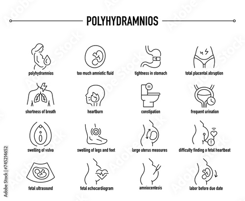 Polyhydramnios symptoms, diagnostic and treatment vector icons. Line editable medical icons.