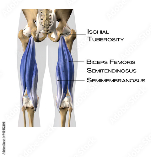 Hamstrings of superficial back line - biceps femoris, semitendinosus, semimembranosus, ischial tuberosity  