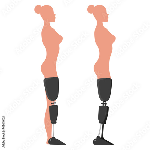 Legs Prosthetic Limb woman Prosthesis, artificial legs side