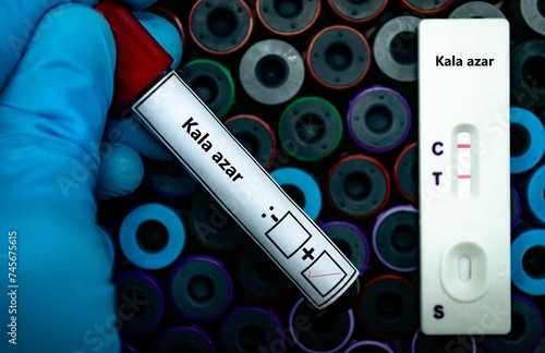 Blood sample of patient positive tested for kala azar by rapid diagnostic test. photo