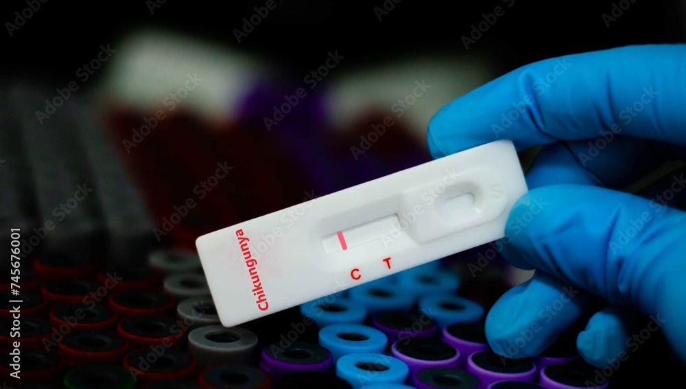 Blood sample of patient negative tested for chikungunya virus by rapid diagnostic test.