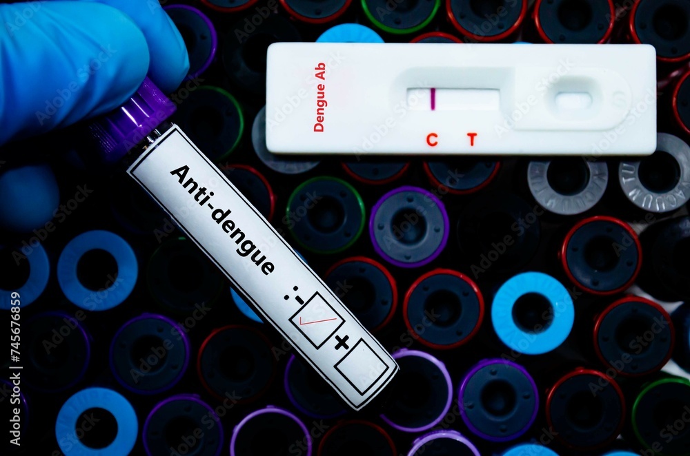 Fototapeta premium Blood sample of patient negative tested for anti-dengue virus by rapid diagnostic test.
