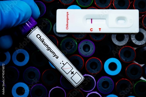 Blood sample of patient negative tested for chikungunya virus by rapid diagnostic test. photo