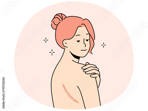 Naked woman with scar on back. Female demonstrate mark or wound on body. Skin imperfection. Vector illustration.