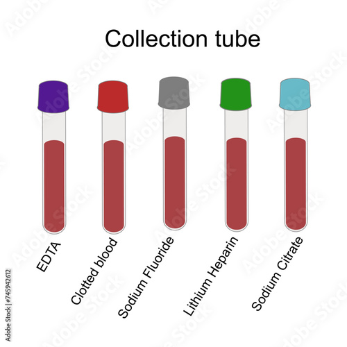The Type of blood collection tube for suitable testing : EDTA, Clotted blood, Sodium Fluoride, Lithium Heparin and Sodium Citrate tube in the cap color: purple, red, gray, green and light blue.