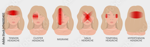 Vector illustration of a girl having a headache. Localization and types of headaches. Neurology and medicine.