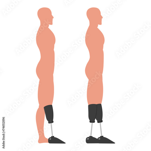 Artificial limb legs