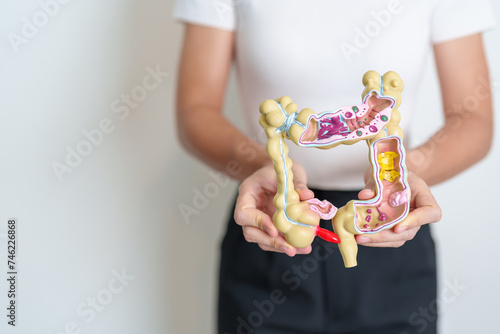 Woman holding human Colon anatomy model. Colonic disease, Large Intestine, Colorectal cancer, Ulcerative colitis, Diverticulitis, Irritable bowel syndrome, Digestive system and Health concept photo