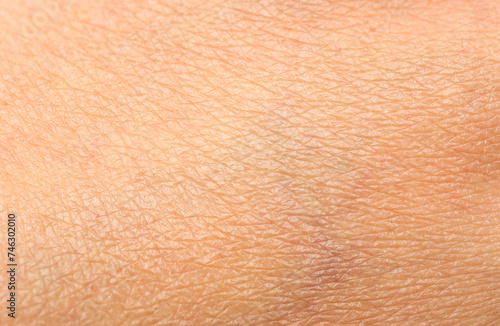 Dry human skin as background. Human skin texture.Macro photo