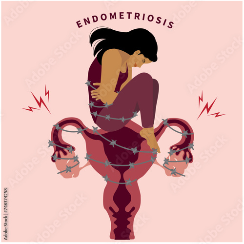 Women suffer with Pelvic pain in flat illustration