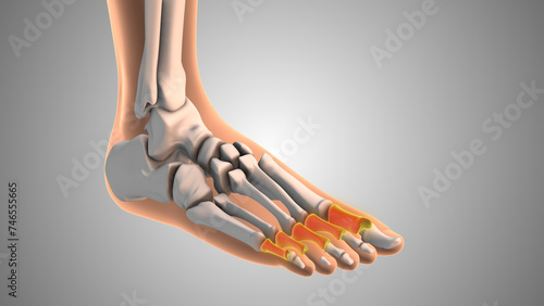 Slika na platnu Phalanges that burn and tingle