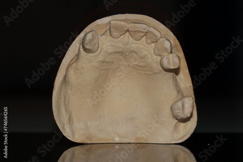 dental technician model removable prosthesis PAPM cobalt chrome resin wax tooth denture frame photo