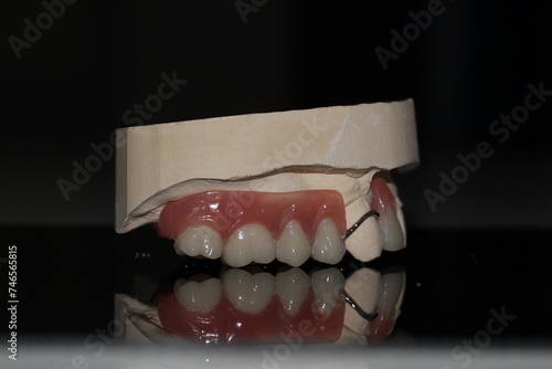 dental technician model removable prosthesis PAPM cobalt chrome resin wax tooth denture frame photo