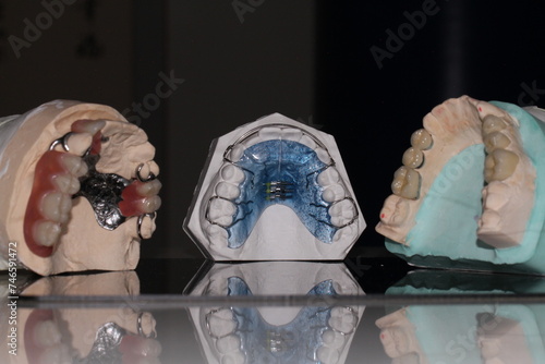 dental technician model orthosis resin wax tooth  removable prosthesis PAPM cobalt chrome resin wax tooth denture frame  fixed prosthesis ceramic wax