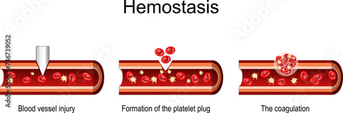 Hemostasis. Cross section of a Blood Vessel. wound healing