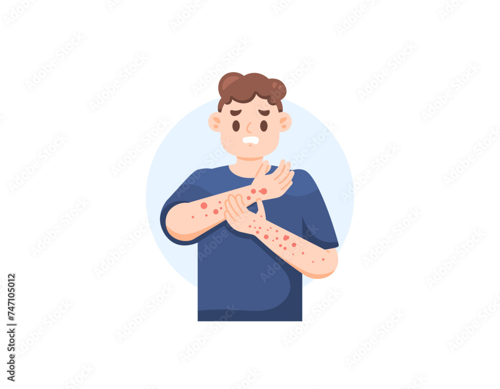 Vecteur Stock illustration of a man with red bumps on his hands due to allergies. scratching