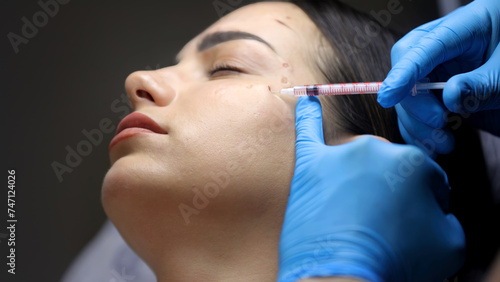 Close-up of a woman's face undergoing cosmetic injections. Wrinkles as a manifestation of skin aging. Injection procedures for facial skin rejuvenation.