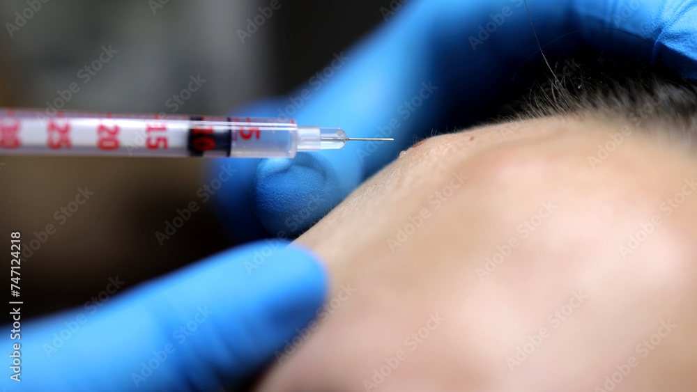 A cosmetologist gives a beauty injection to a woman's face in a cosmetology center, close-up. Concept of aesthetic medicine, cosmetic injections and injection surgery. A cosmetologist gives a beauty injection to a woman's face in a cosmetology center, close-up. Concept of aesthetic medicine, cosmetic injections and injection surgery.