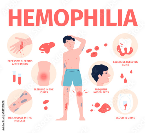 Hemophilia symptoms. Medical poster about men blood problems. Healthcare hospital info poster about blood loss. Self safety recent vector concept