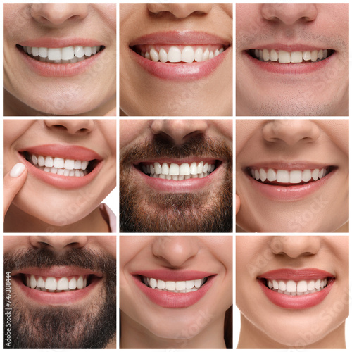 People showing white teeth  closeup. Collage of photos