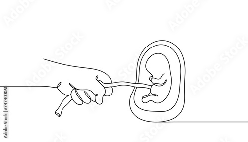 Embryo. Uterus. Umbilical cord. Hand