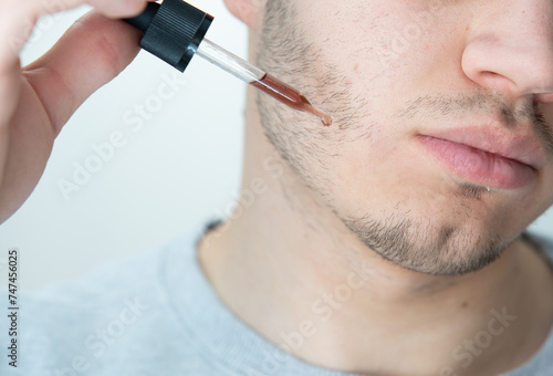 young man applying beard growth oil with pipette close up. Close-up image of handsome man holding pipette with oil for beard  Handsome man applying cosmetic serum with pipette onto face  