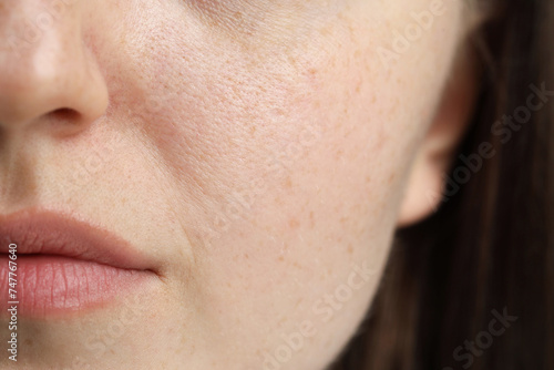 Macro view of woman with dry skin