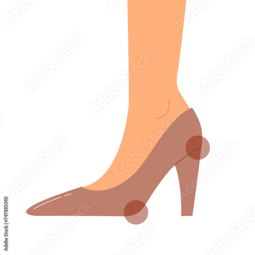 Hurt area of foot because of wearing high heels. Foot and ankle pain, blister and suffering. Bones, muscles and ankles damage. Flat vector illustration.