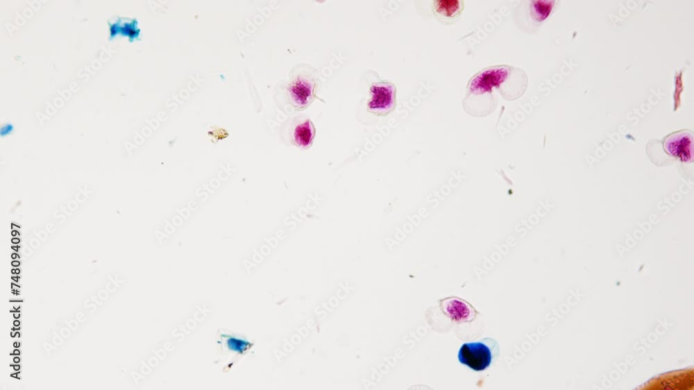 Plant pollen under microscope, 100x. Different examples of pollen from different plants. Smooth