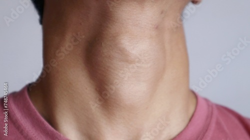 Photo of a man's Adam's apple and neck area protruding against photo