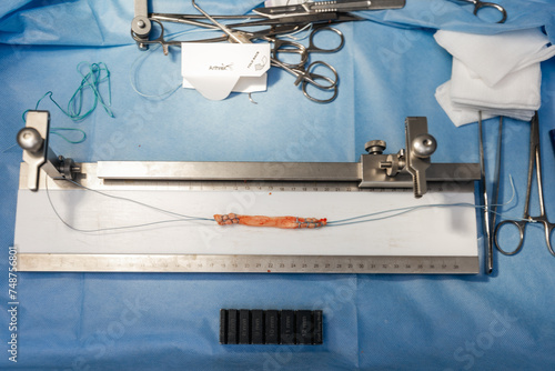 Fotografia Arthroscopic anterior cruciate ligament reconstruction