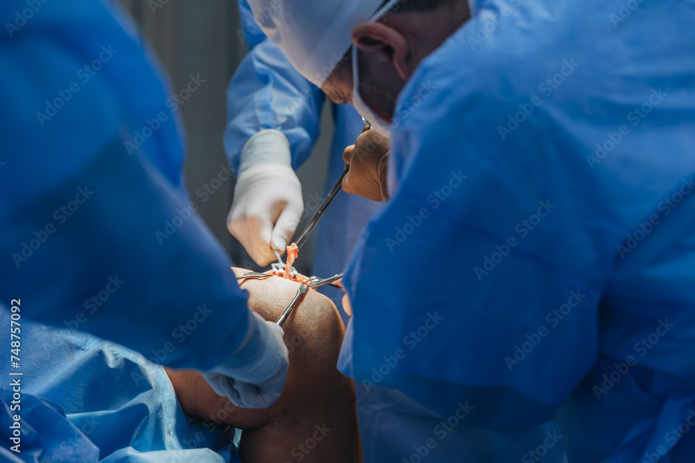02.01.2024 Vinnytsia, Ukraine: two trauma surgeons work on a patient's knee joint reconstruction on the operating table 02.01.2024 Vinnytsia, Ukraine: two trauma surgeons work on a patient's knee joint reconstruction on the operating table