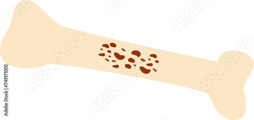 Osteoporosis bone