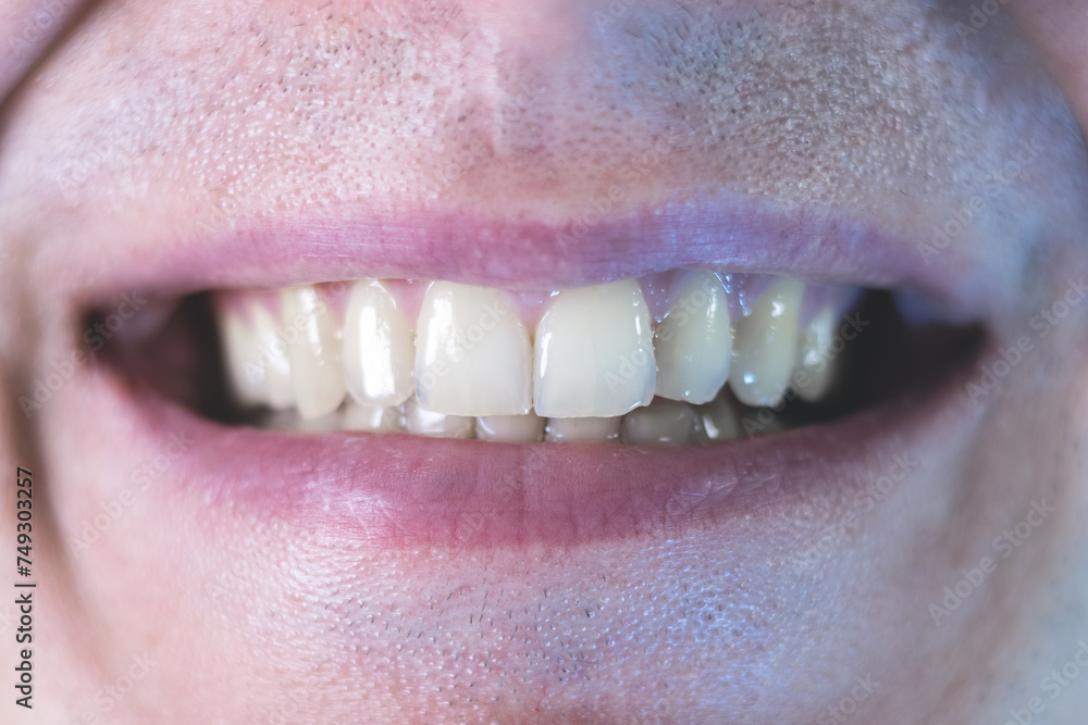 Fototapeta premium Man is smiling with teeth. Close up, man's mouth and lips.