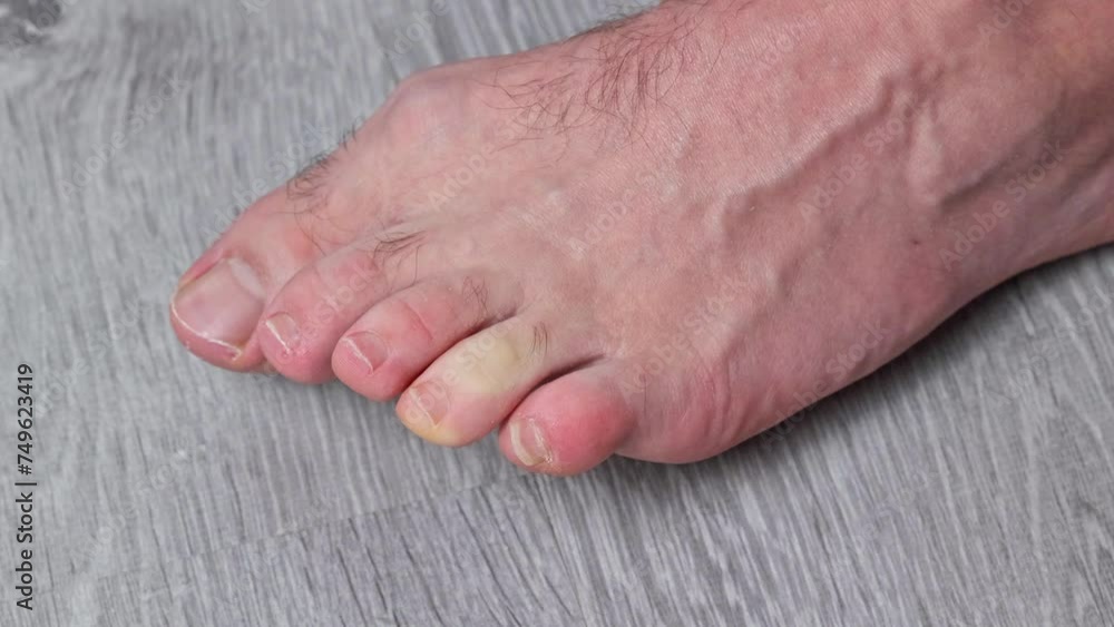 Man cutting toenails with scissors. Male cut toenails on foot. Foot care. Man cutting toenails with scissors. Male cut toenails on foot. Foot care.