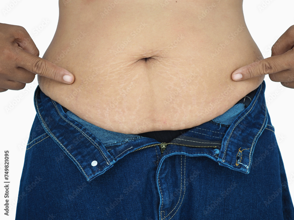Naklejka premium Woman show off the belly after birth have stretch marks on white background. Closeup photo, blurred.