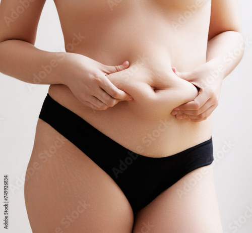 Natural Real woman body. Moms postpartum body with postnatal flaws, stretch marks, fat and scars. Female belly with pregnancy stretch marks closeup on a gray background