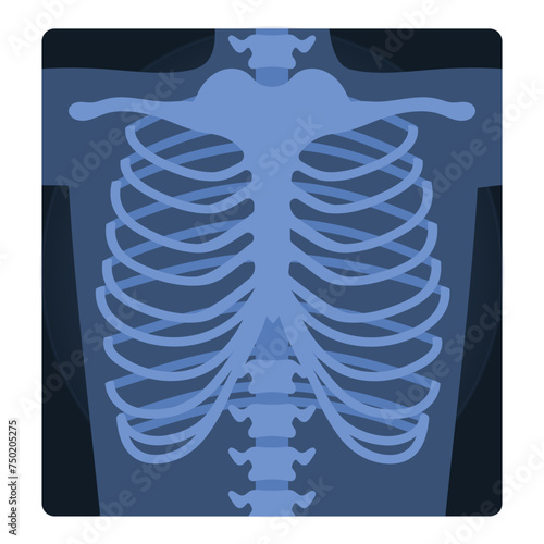 Medical xray scan of human chest. Medical skeleton test, body radiography cartoon vector illustration
