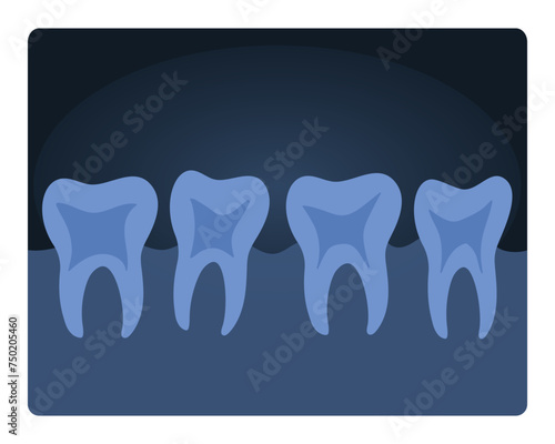 Dental xray scan. Human teeth radiography, medical test of human tooth cartoon vector illustration
