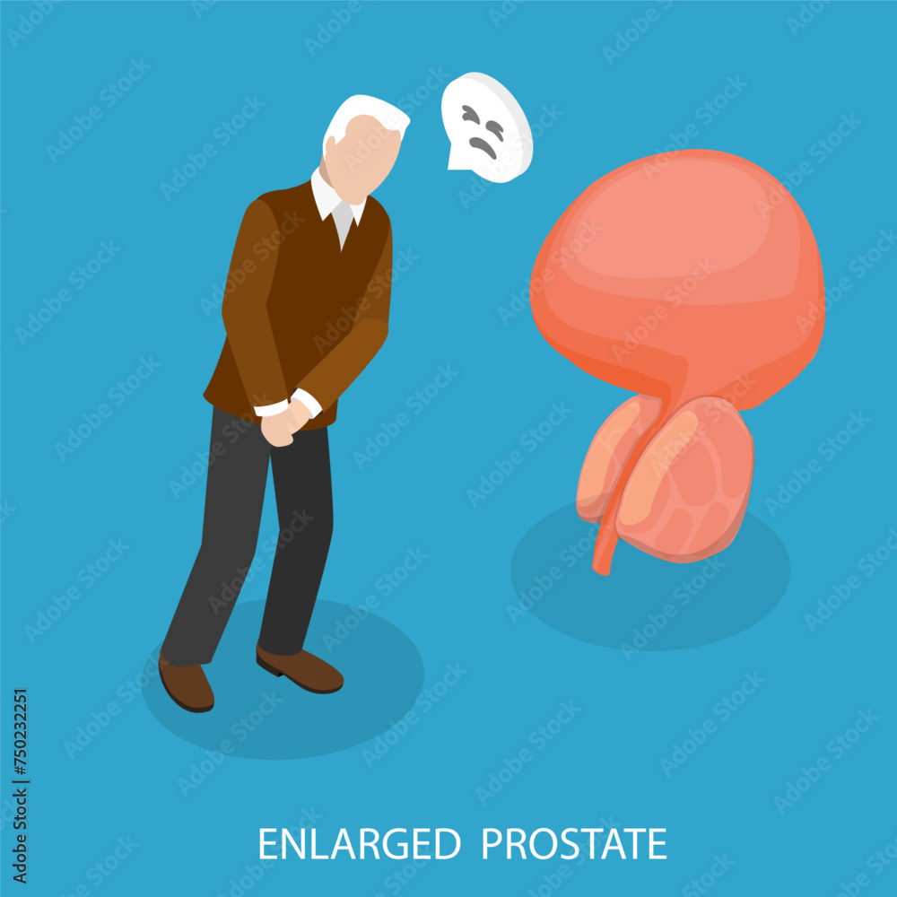 3D Isometric Flat Vector Illustration of Enlarged Prostate, Problems of Male Reproductive System 3D Isometric Flat Vector Illustration of Enlarged Prostate, Problems of Male Reproductive System