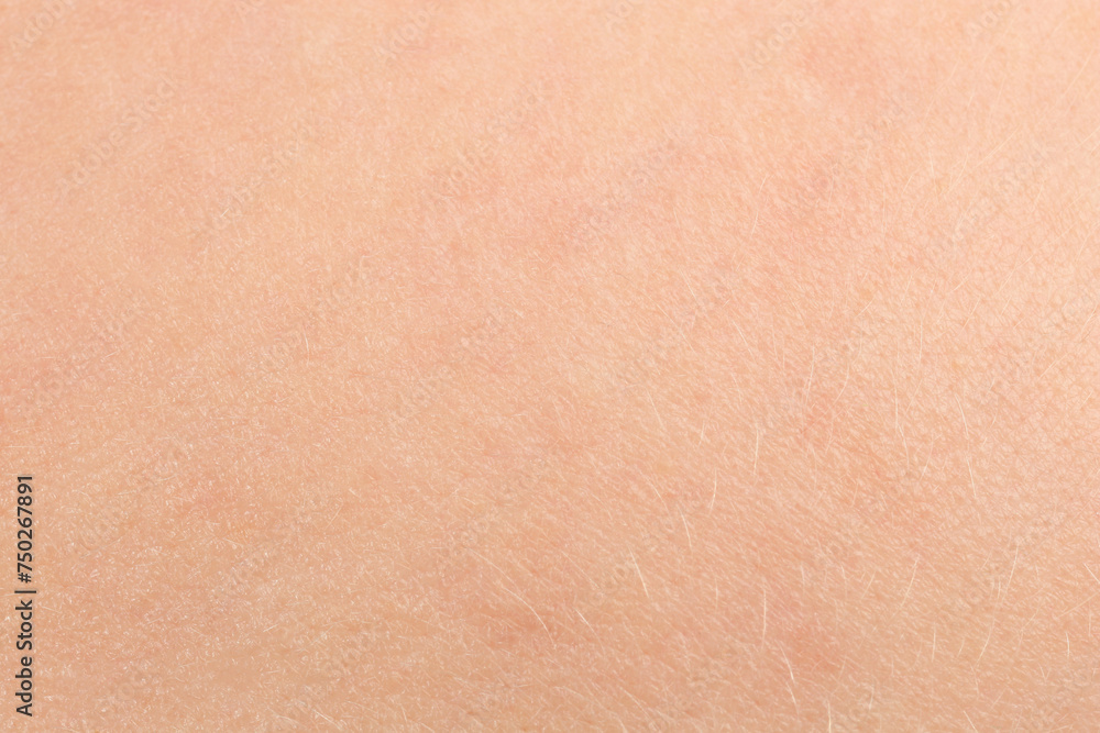 Texture of dry skin as background, macro view Texture of dry skin as background, macro view