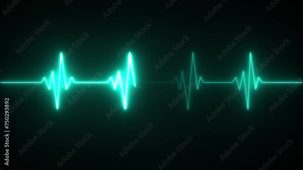 This is an electrical activity of heart. This can present various types of diseases of heart. This is used as initial investigation of heart. This is an electrical activity of heart. This can present various types of diseases of heart. This is used as initial investigation of heart.