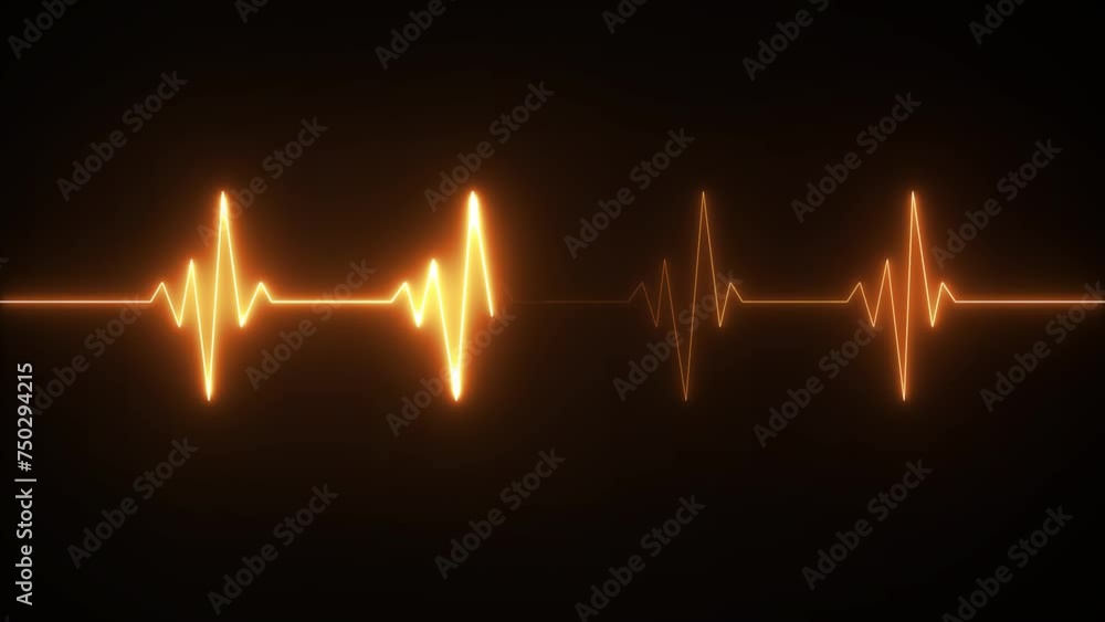 This is an electrical activity of heart. This can present various types of diseases of heart. This is used as initial investigation of heart. This is an electrical activity of heart. This can present various types of diseases of heart. This is used as initial investigation of heart.