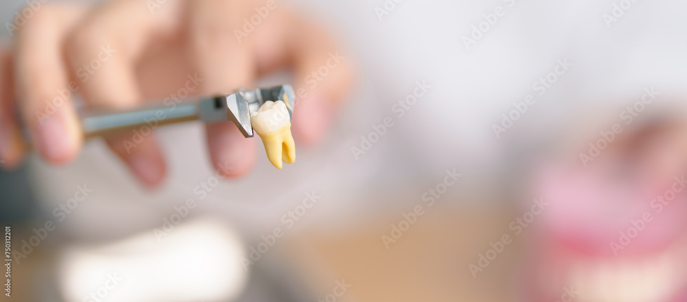 Dentist with tooth Anatomy model. Oral Teeth and disease, Scrape off tartar. March Oral health, Dentist Day, False Teeth. Toothache and Children Dental Health Month and Orthodontic Health Day