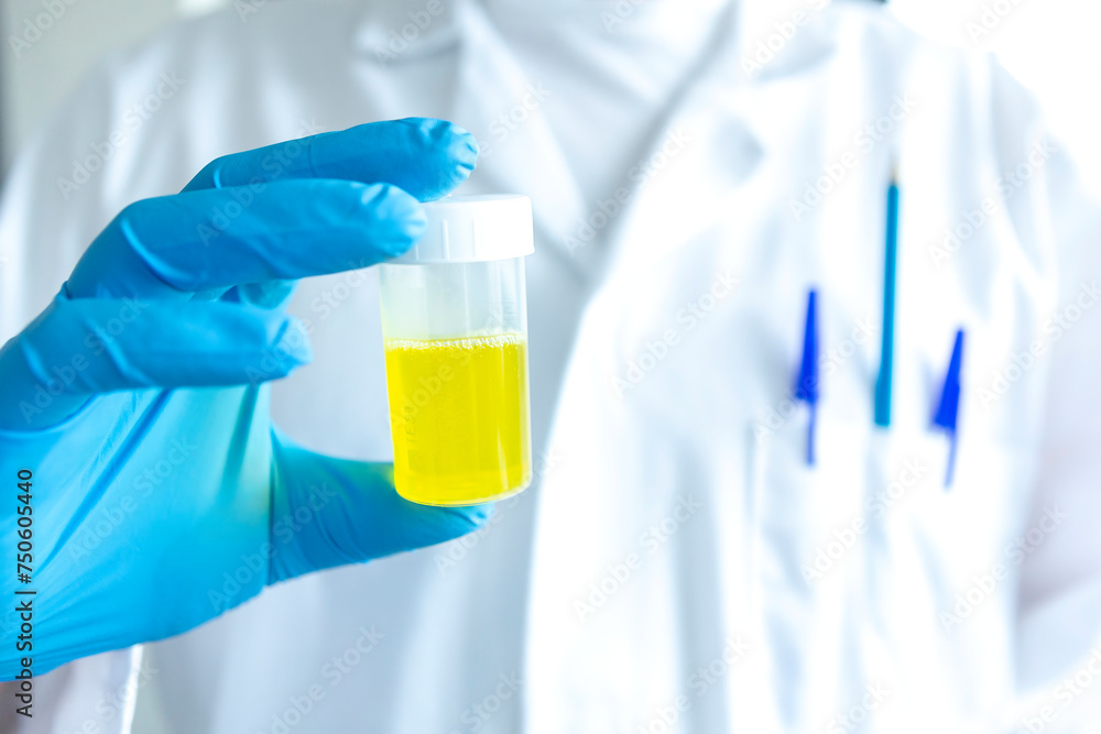 Scientist with a urine cup