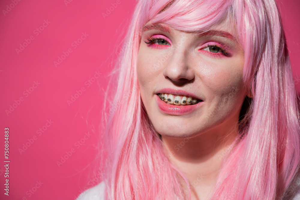Close-up portrait of a young woman with braces in a pink wig on a pink background. Close-up portrait of a young woman with braces in a pink wig on a pink background.