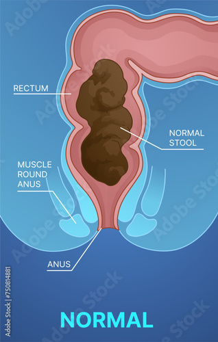 Normal stool.  Healthcare infographic. Healthcare illustration. Vector illustration.