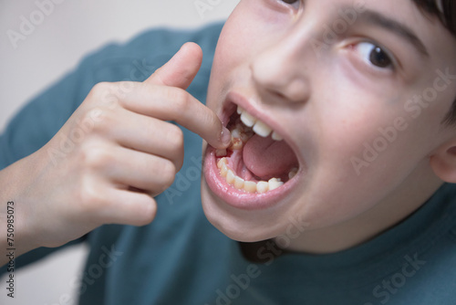 A boy's tooth falls out of his mouth in close-up
